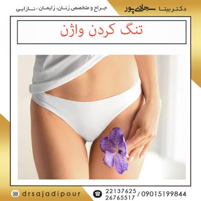 تنگ کردن واژن؛ معرفی روش ها، هزینه و عوارض