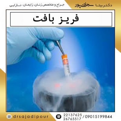 فریز بافت