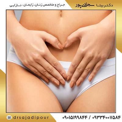 کربوکسی تراپی واژن