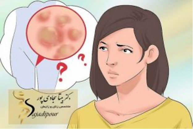 بیماری زگیل تناسلی چیست؟