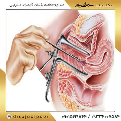 میزان درد کولپوسکوپی