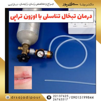 درمان تبخال تناسلی با اوزون تراپی