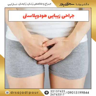 جراحی زیبایی هودوپلاستی