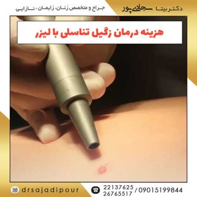 هزینه درمان زگیل تناسلی با لیزر: تعرفه مصوب در 1404