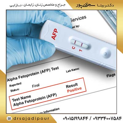 تست آلفا فتوپروتئین