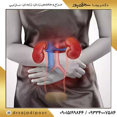 هر آنچه باید در مورد عفونت ادراری بدانید!