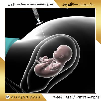 آمنیوسنتز چیست؟ کاربرد + مراقبت ها [متخصص زنان و زایمان]