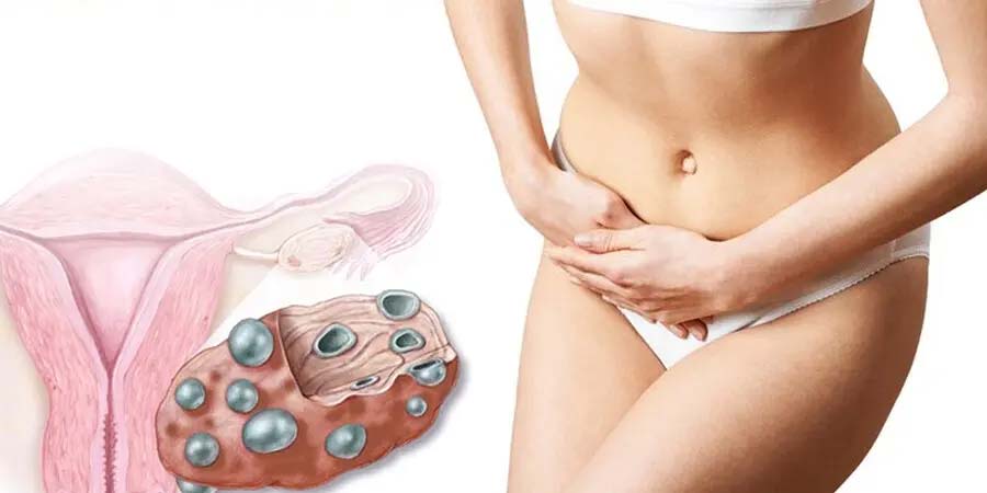 علل اختلالات هورمونی
