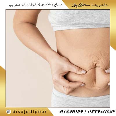 عوارض مینی ابدو
