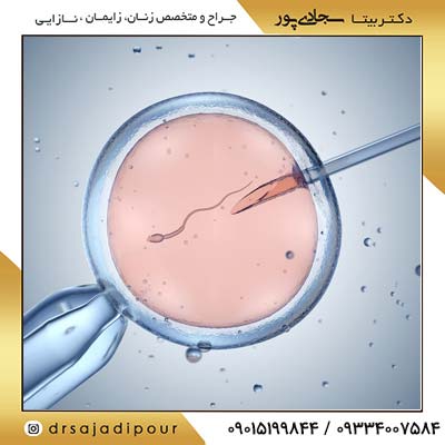 عوامل مؤثر بر موفقیت IUI