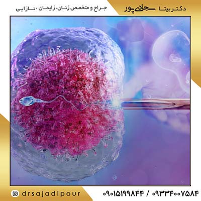 پروسه لقاح داخلی رحمی