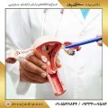 بیوپسی دهانه رحم