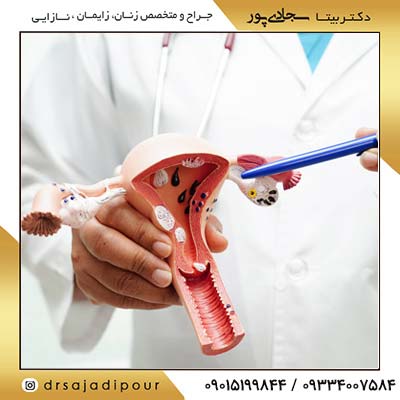 بیوپسی دهانه رحم چیست؟ نحوه انجام + نتایج [متخصص زنان و زایمان]