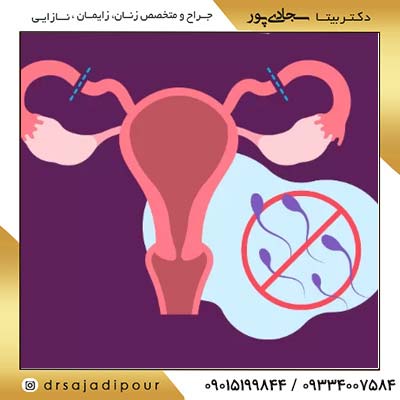 پشیمانی پس از عمل