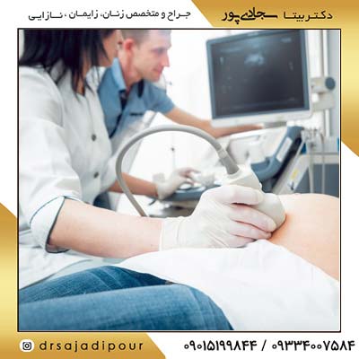 انواع سونوگرافی داپلر
