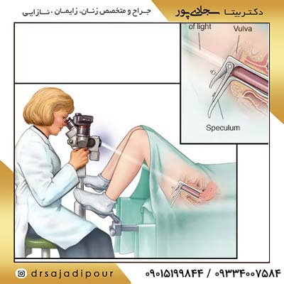 فرق پاپ اسمیر و کولپوسکوپی: بررسی دقیق دو آزمون مهم در تشخیص سرطان دهانه رحم