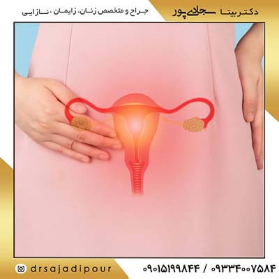 برداشتن تخمدان: دلایل، عوارض و مراقبت‌های پس از جراحی