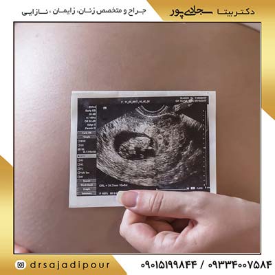پریناتولوژی؛ شاخه‌ای حیاتی از پزشکی مادر و جنین