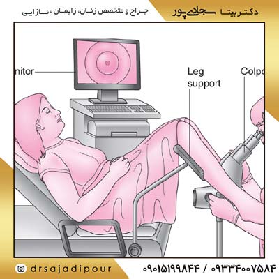 پاپ اسمیر چیست و چه کاربردی دارد؟